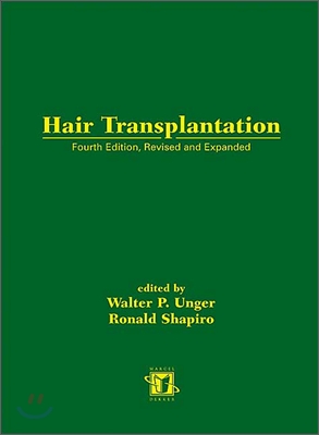 Hair Transplantation, Fourth Edition