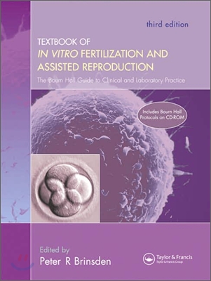 A Textbook of In Vitro Fertilization and Assisted Reproduction