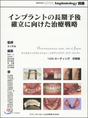 インプラントの長期予後確立に向けた治療戰