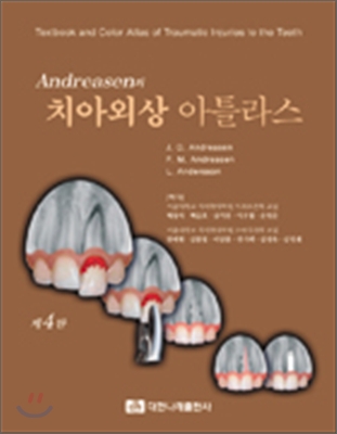 Andreasen의 치아외상 아틀라스