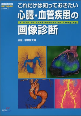 これだけは知っておきたい 心臟.血管疾患の畵像診斷