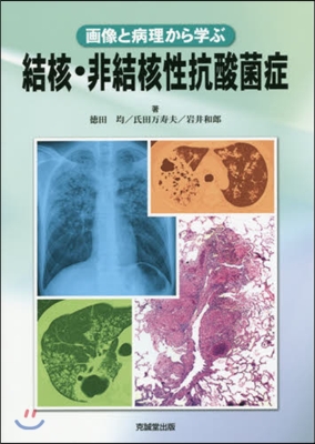 畵像と病理から學ぶ結核.非結核性抗酸菌症