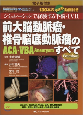 前大腦動脈瘤.椎骨腦底動脈瘤のすべて