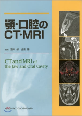 顎.口腔のCT.MRI