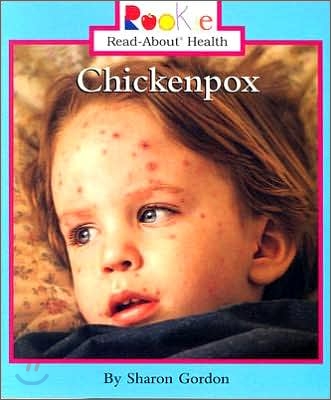 Chickenpox