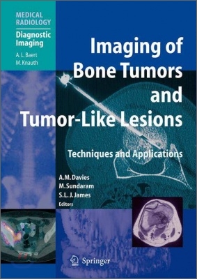 Imaging of Bone Tumors and Tumor-Like Lesions: Techniques and Applications