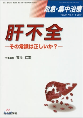 肝不全－その常識は正しいか?－