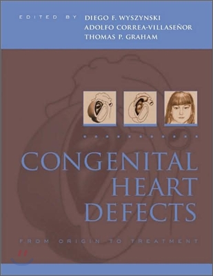 Congenital Heart Defects: From Origin to Treatment