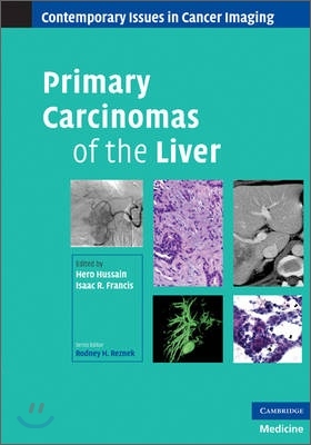 Primary Carcinomas of the Liver