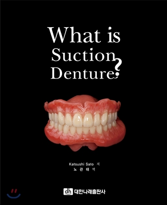 What is suction denture?