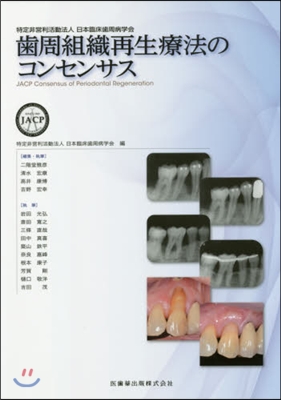 齒周組織再生療法のコンセンサス