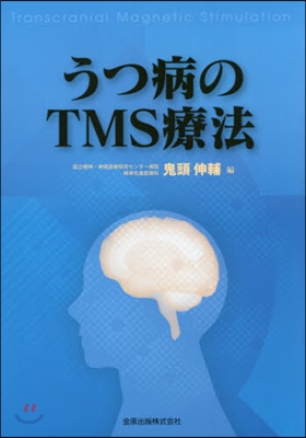 うつ病のTMS療法