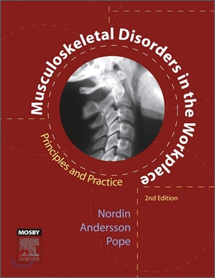 Musculoskeletal Disorders in the Workplace