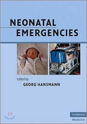Neonatal Emergencies: A Practical Guide for Resuscitation, Transport and Critical Care of Newborn Infants