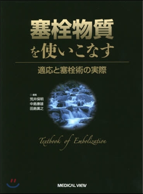 塞栓物質を使いこなす 適應と塞栓術の實際