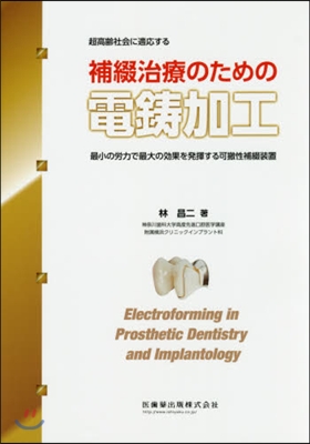 補綴治療のための電?加工 最小の勞力で最