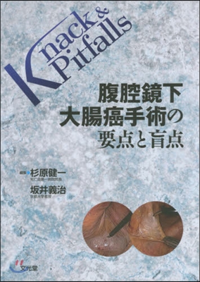 腹腔鏡下大腸癌手術の要点と盲点