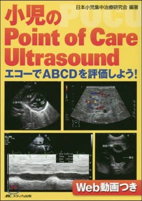 小兒のPoint of Care Ult