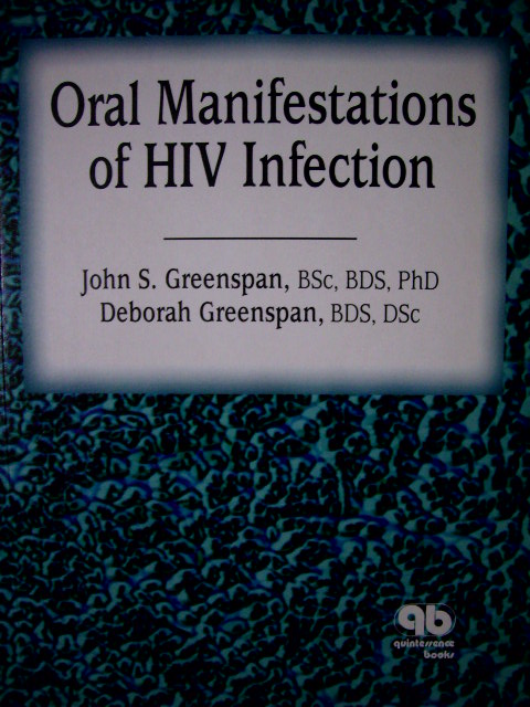 Oral Manifestations of HIV Infection