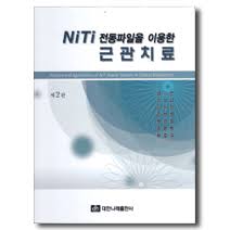 NITI 전동파일을 이용한 근관치료