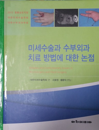 미세수술 수부외과 치료방법에 대한 논점