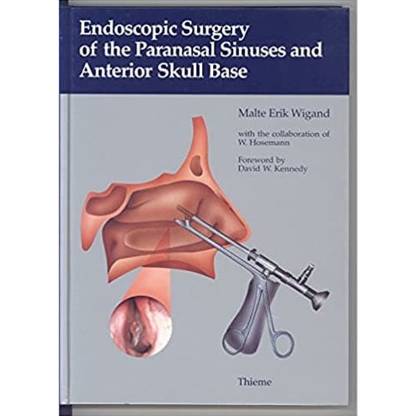 Endoscopic Surgery of the Paranasal Sinuses and Anterior Skull Base Hardcover ? Import, 1 May 1990