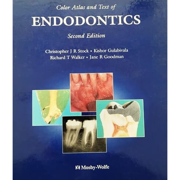 Color Atlas and Text of ENDODONTICS (2nd edition)