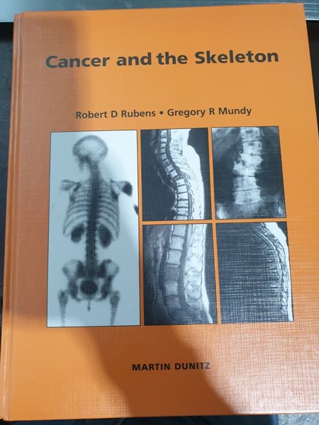 Cancer and the Skeleton