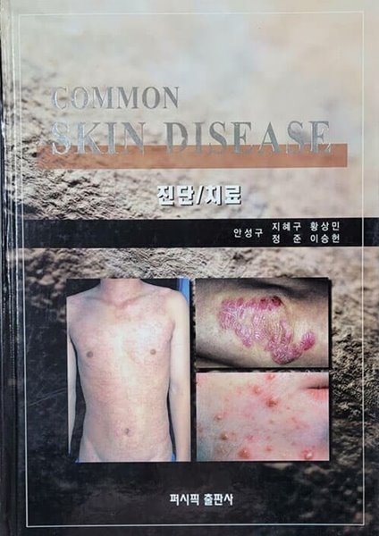 Common Skin Disease