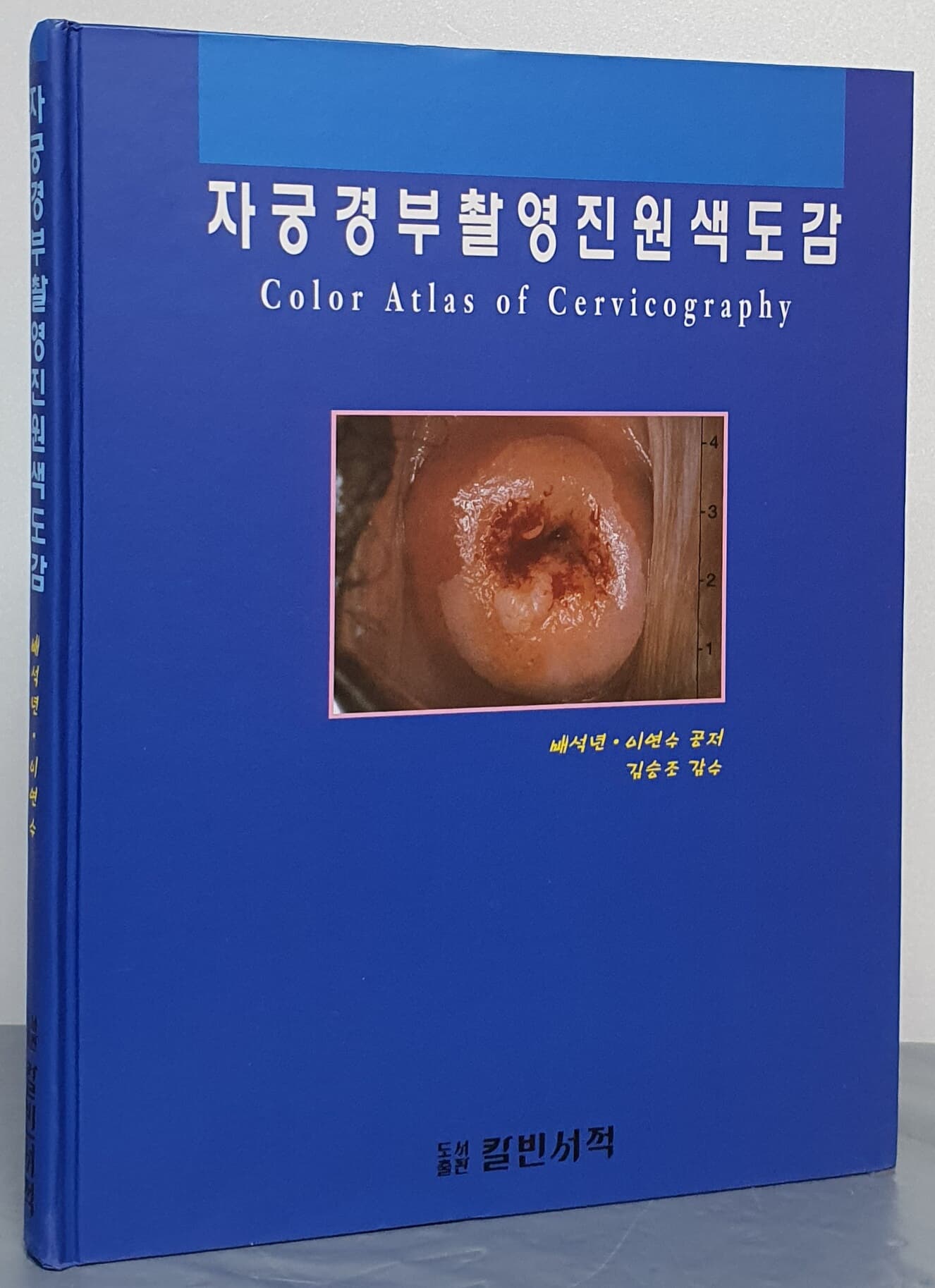 자궁경부촬영진원색도감