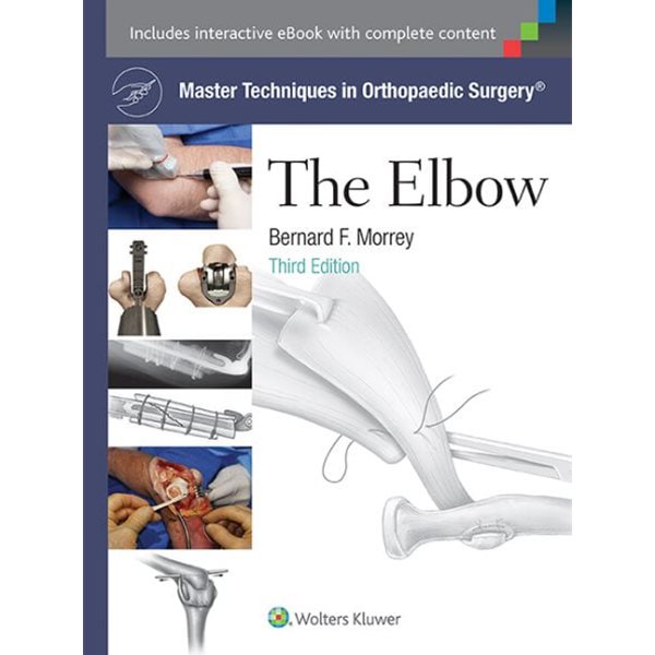 The Elbow, 3/ed