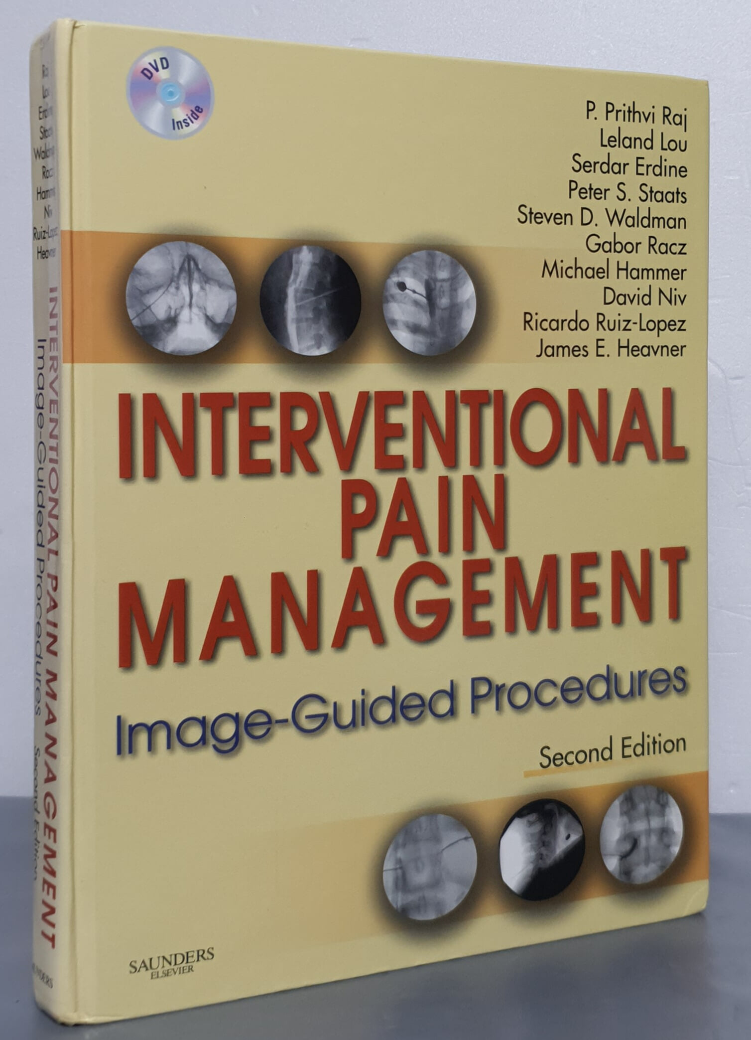 Interventional Pain Management (Hardcover, DVD, 2nd) - Image-Guided Procedures 