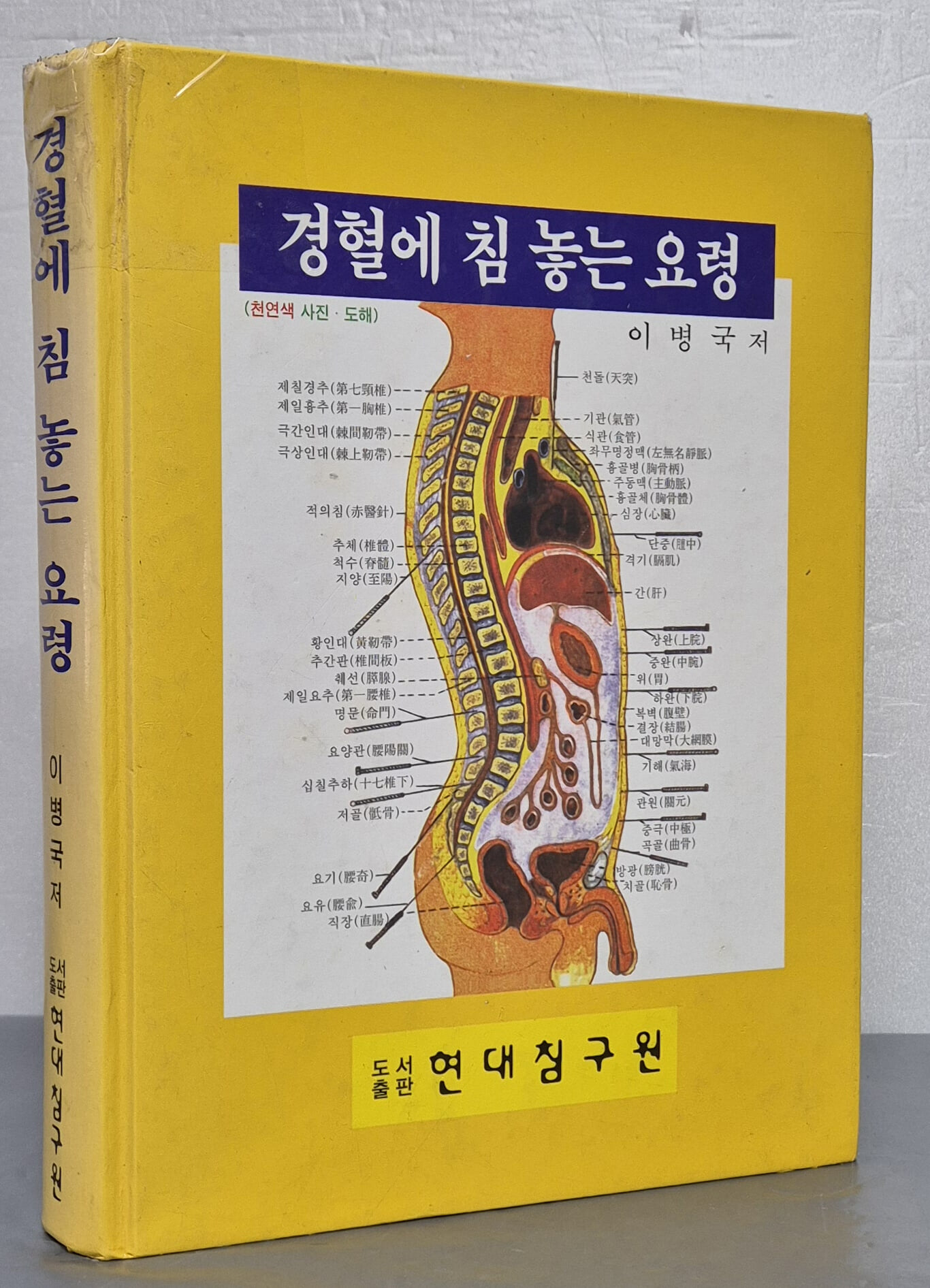 경혈에 침 놓는 요령