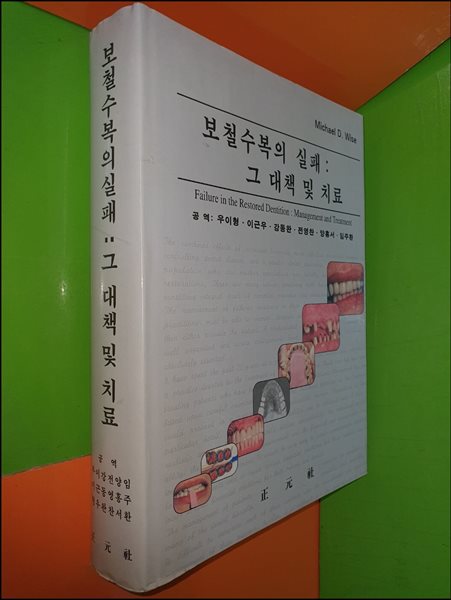 보철 수복의 실패 : 그 대책 및 치료