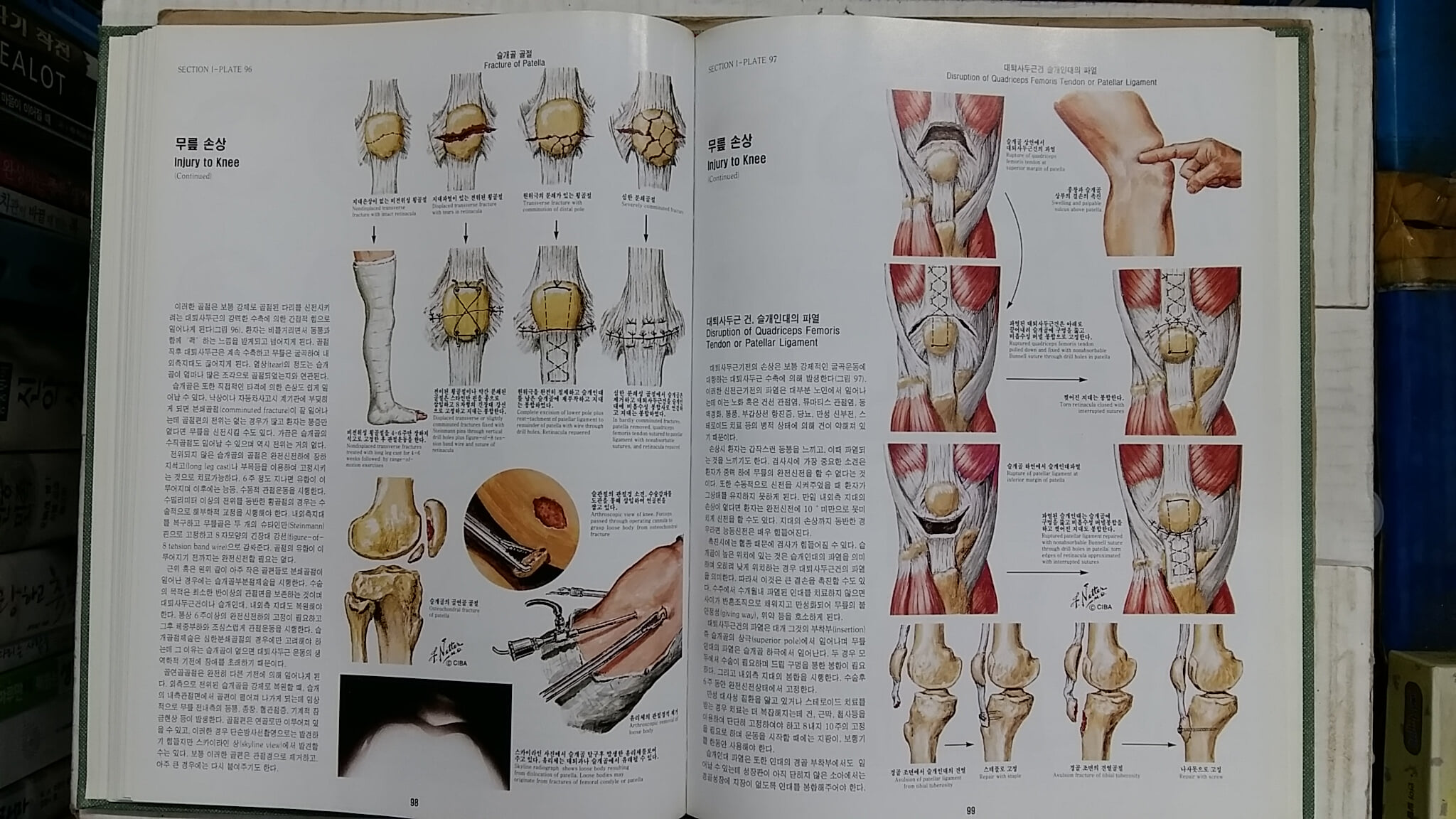 CIBA 원색도해의학총서(총13권중 1권 부족,현12권)